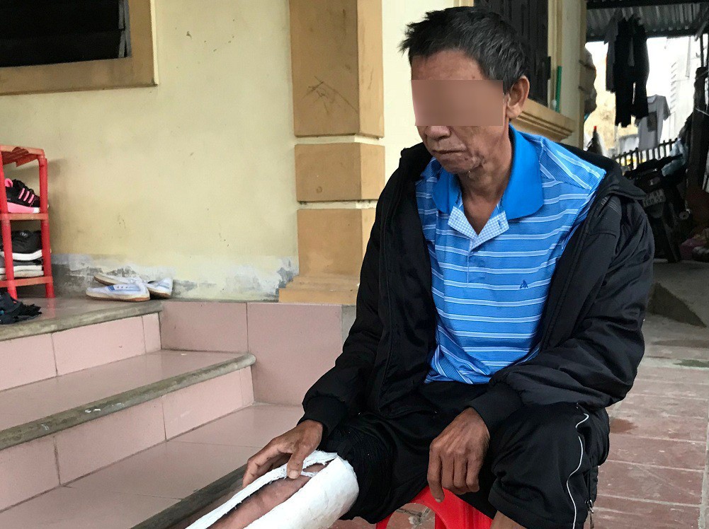 Con đánh bố gãy xương sườn, mua xăng về dọa “thiêu sống”