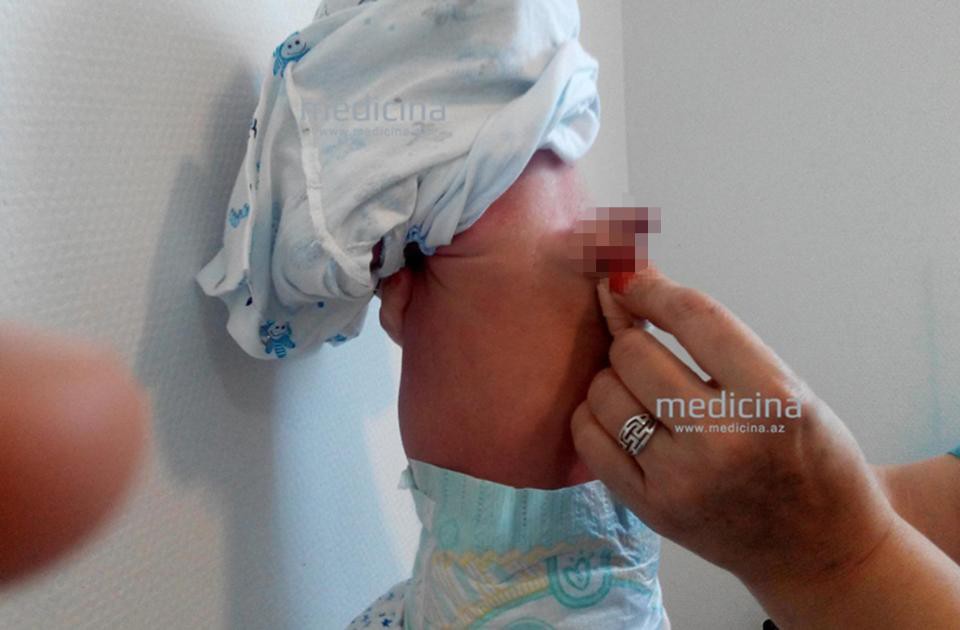 Cậu bé ra đời với hai bộ phận sinh dục