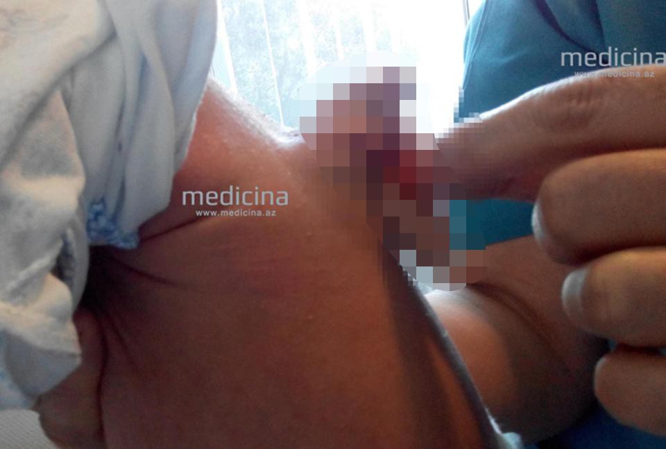 Cậu b&eacute; ra đời với hai bộ phận sinh dục - Ảnh 1.