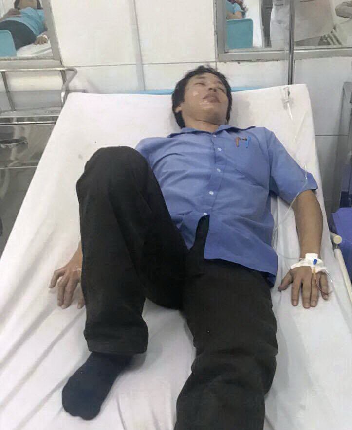 Đồng Nai: Nhiều công nhân bị bỏng do nổ lớn