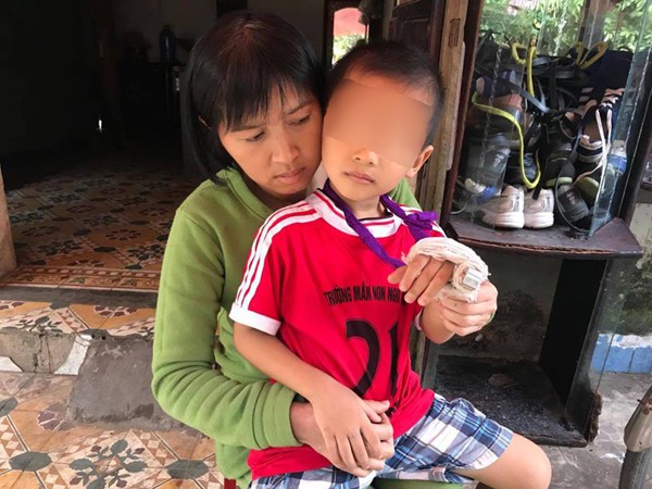 Giáo viên mầm non bị tố đánh trẻ 5 tuổi gãy ngón tay
