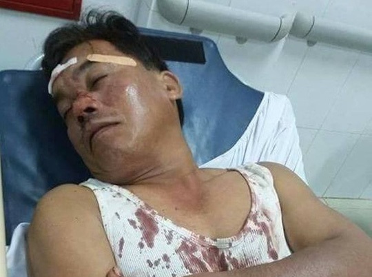 Can ngăn trai làng hỗn chiến, công an xã bị đánh gục tại chỗ