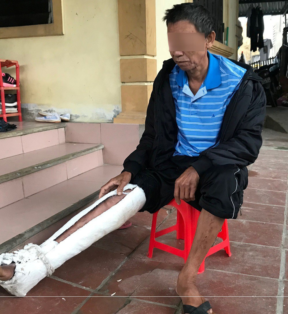 Con đ&aacute;nh bố g&atilde;y xương sườn, mua xăng về dọa &ldquo;thi&ecirc;u sống&rdquo; - Ảnh 1.