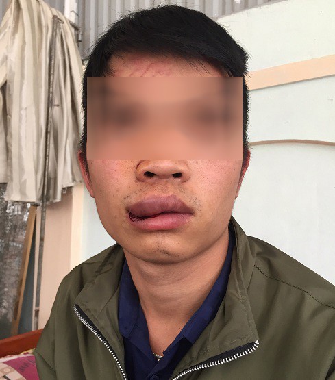 L&aacute;i xe, phụ xe bị c&ocirc;n đồ đ&aacute;nh nhập viện, chủ xe l&agrave;m đơn k&ecirc;u cứu - Ảnh 1.