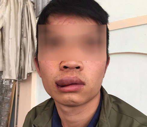 Lái xe, phụ xe bị đánh nhập viện, chủ xe làm đơn kêu cứu