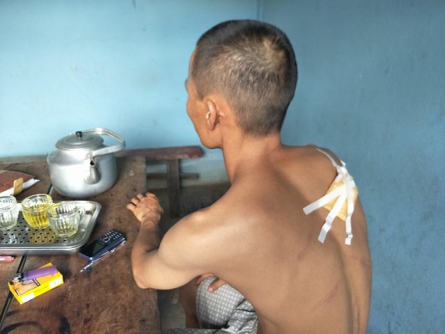 Bắt thanh niên chém dã man thợ xây đến lấy tiền công