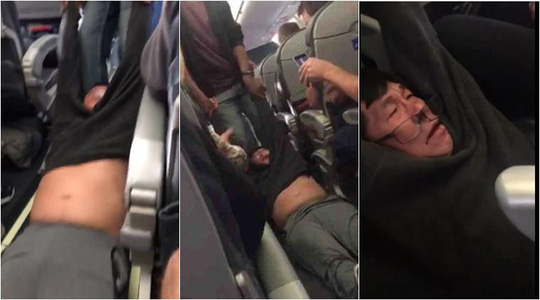 
Vụ việc người đ&agrave;n &ocirc;ng 69 tuổi bị k&eacute;o l&ecirc; khỏi m&aacute;y bay của h&atilde;ng United Airlines khiến dư luận bức xức. Ảnh: Facebook

 
