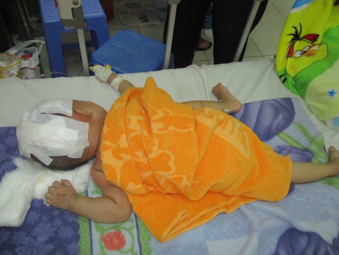 Bé 15 tháng tuổi văng khỏi xe máy, chấn thương sọ não