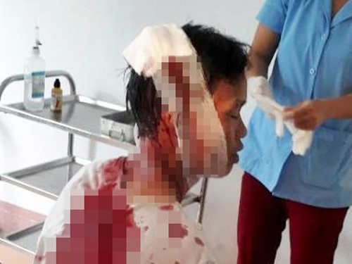 Đến lấy tiền công, thợ xây bị gia chủ truy sát chém dã man