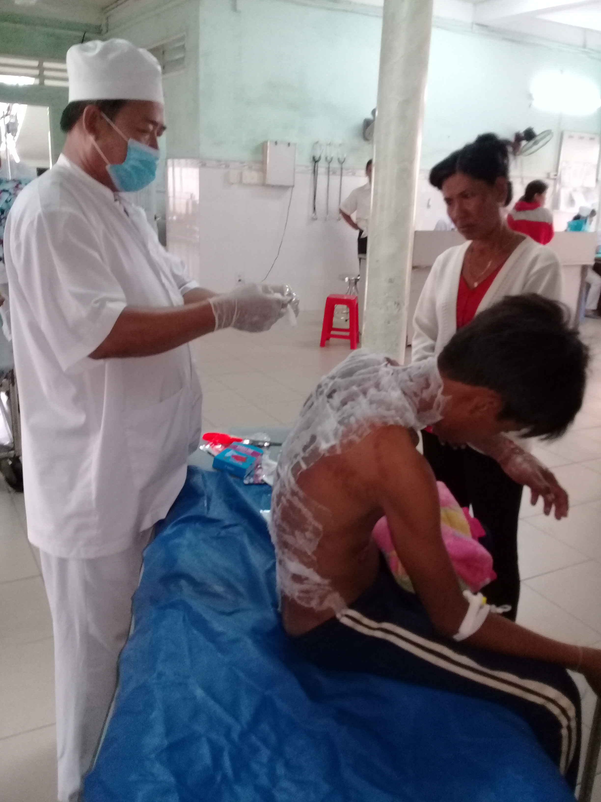 
Em Th. đang điều trị vết bỏng rất nặng tại Bệnh viện Đa khoa Tr&agrave; Vinh
