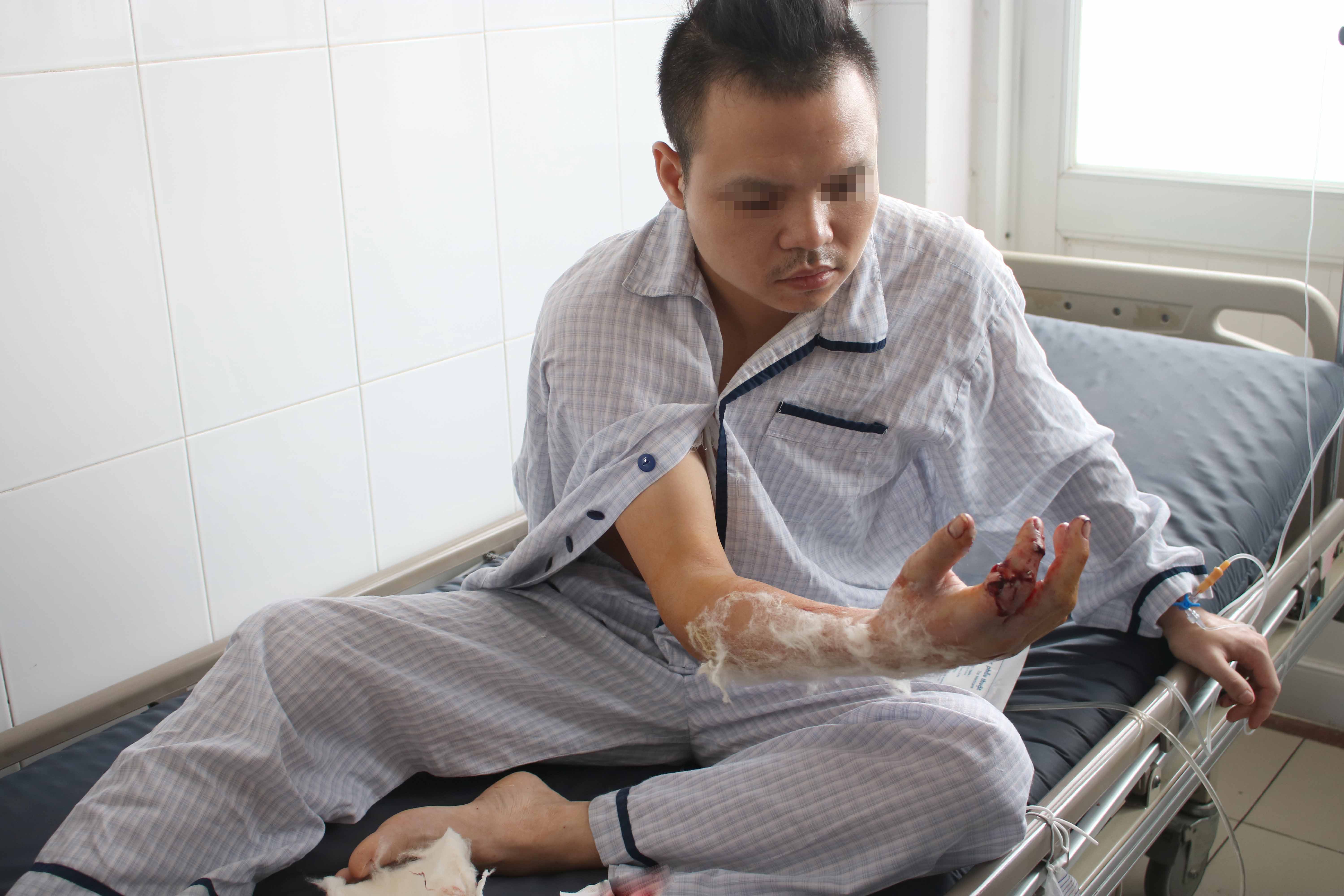 Để máy xay thịt "ăn" luôn ngón tay