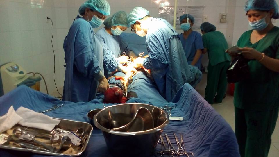 Lấy khối u nặng tới 4kg ra khỏi cơ thể một phụ nữ