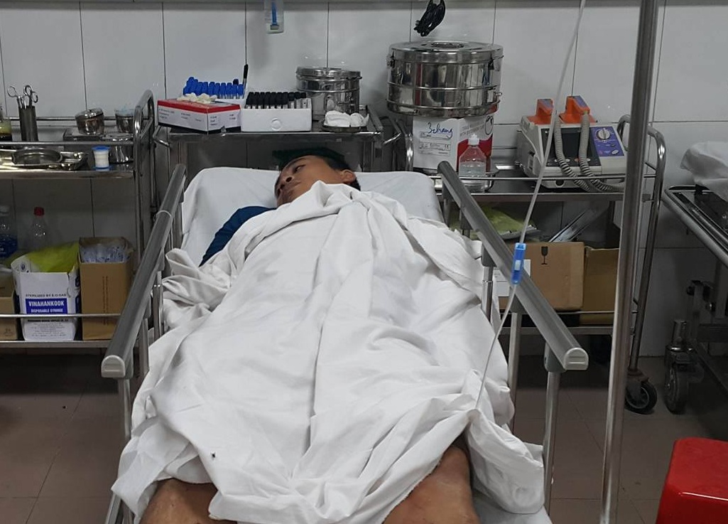 Xe kh&aacute;ch t&ocirc;ng xe bồn chở xăng, 5 người nguy kịch - Ảnh 2.