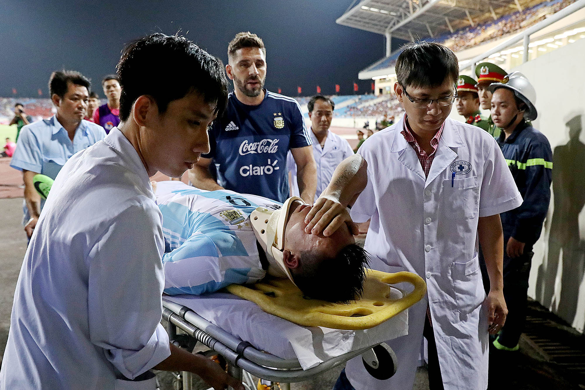 Cầu thủ U20 Argentina bị gãy mũi - Ảnh 1.