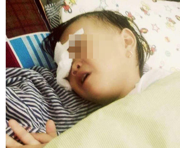 Chơi trong sân, bé 2 tuổi bị gà chọi đá hỏng mắt