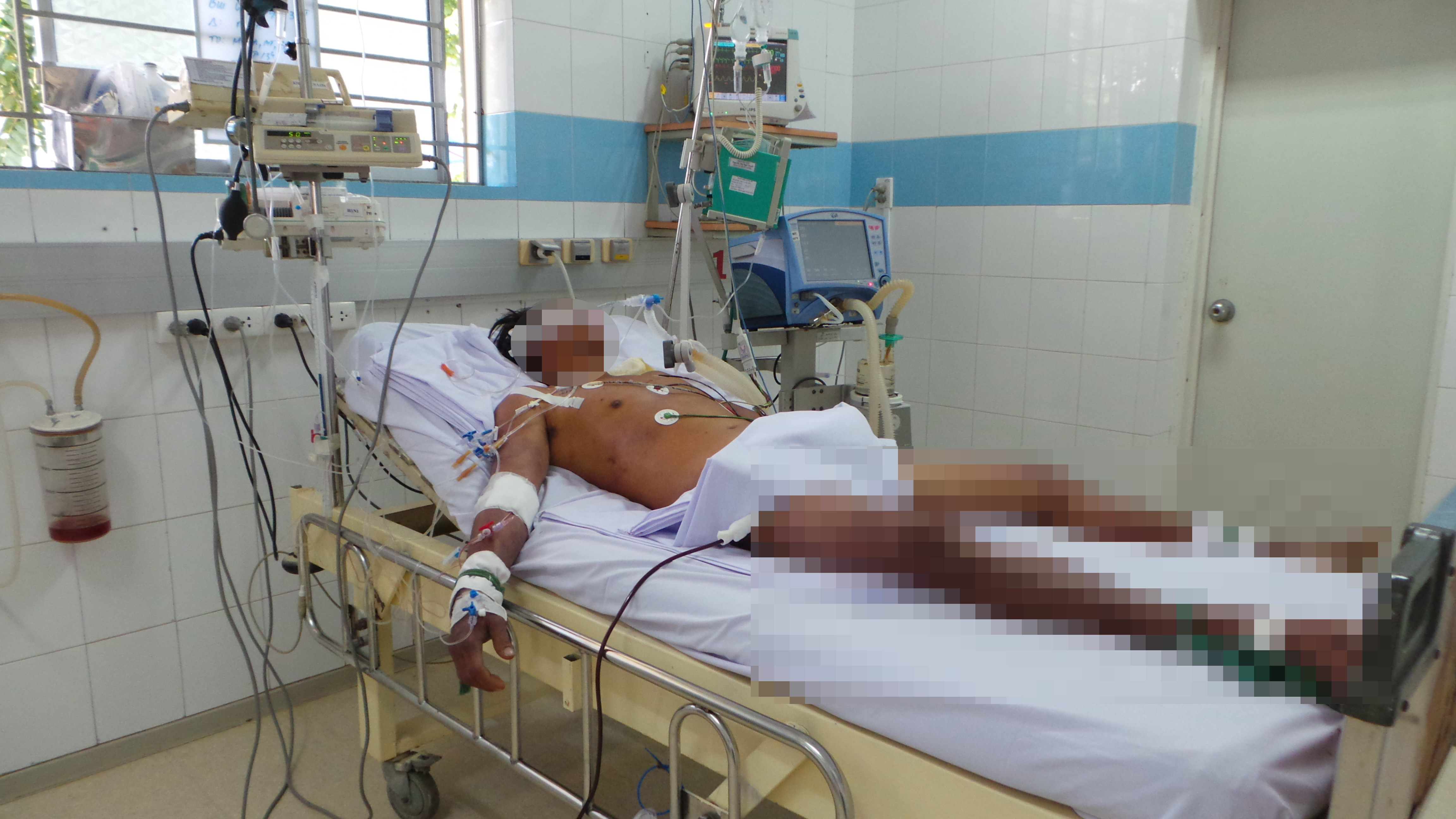 Báo động hiểm họa tiết canh!