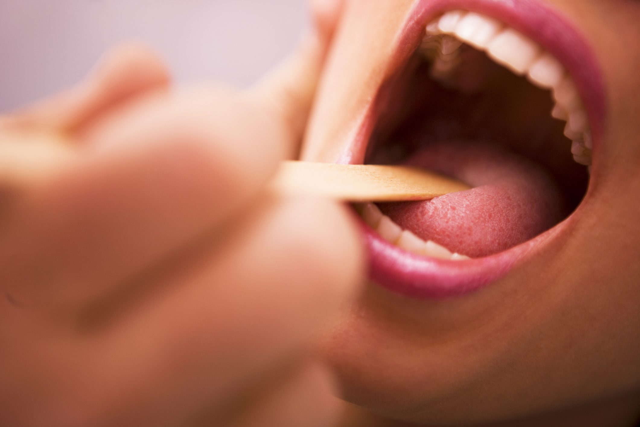 Lý do người Việt dễ bị ung thư vòm họng nhất thế giới