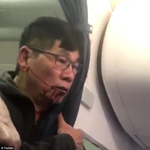Bác sĩ gốc Việt có lợi thế nếu kiện United Airlines