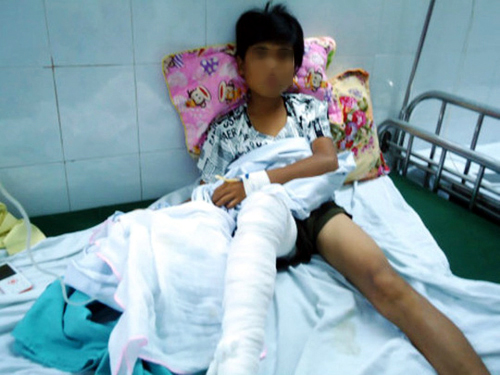 Trèo tường rào, nam sinh 13 tuổi bị hổ vồ trúng chân