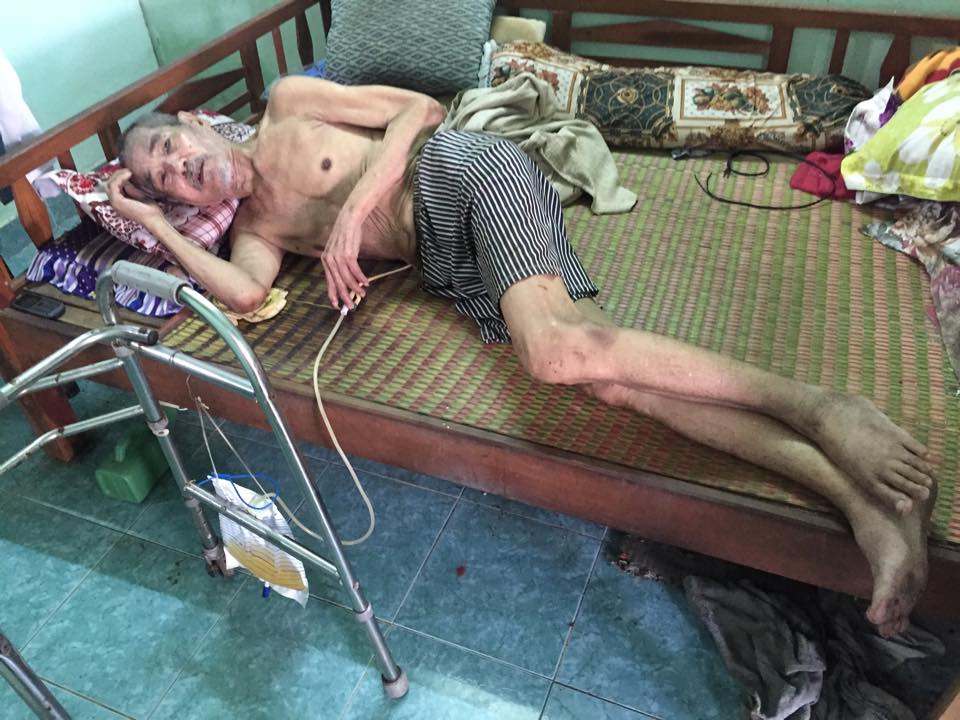 Ba nghệ sĩ sân khấu đang cần sự giúp đỡ