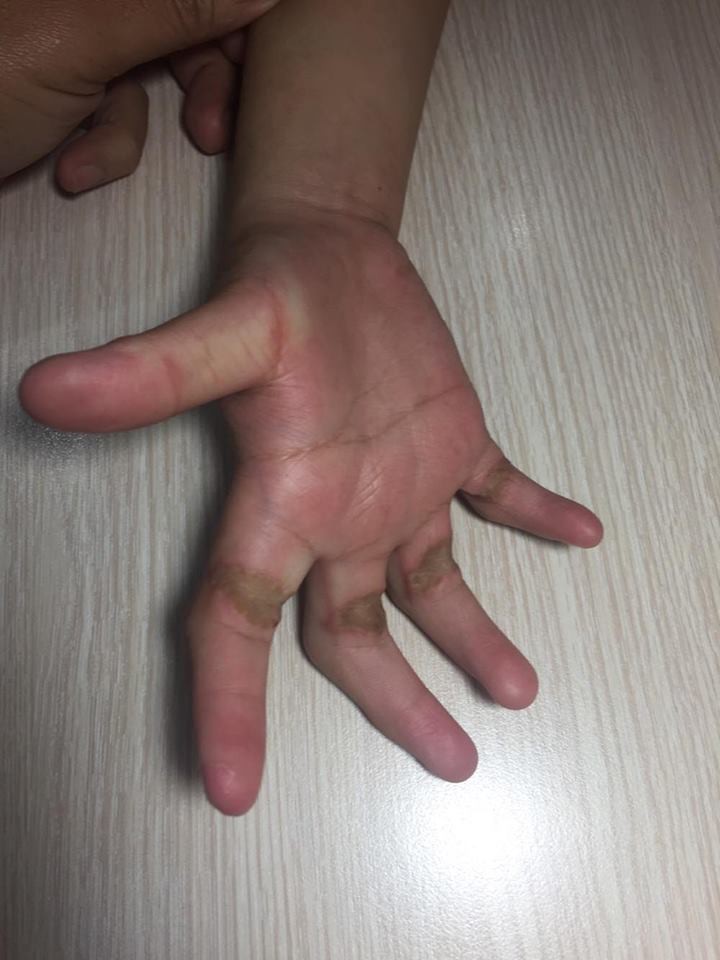 Cô giáo cầu cứu bác sĩ giúp 1 nữ sinh không thể cầm viết