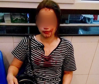 Công an TP Vinh: Sĩ quan công an có mặt nhưng không đánh cô gái - Ảnh 1.