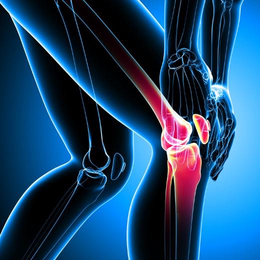 Tập luyện lấy lại ngoại hình, cô gái bị thoái hóa khớp