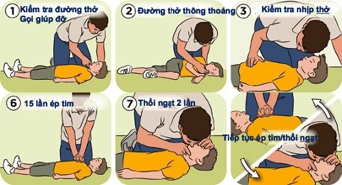 
B&aacute;c sĩ hướng dẫn c&aacute;ch sơ cứu người bị đuối nước
