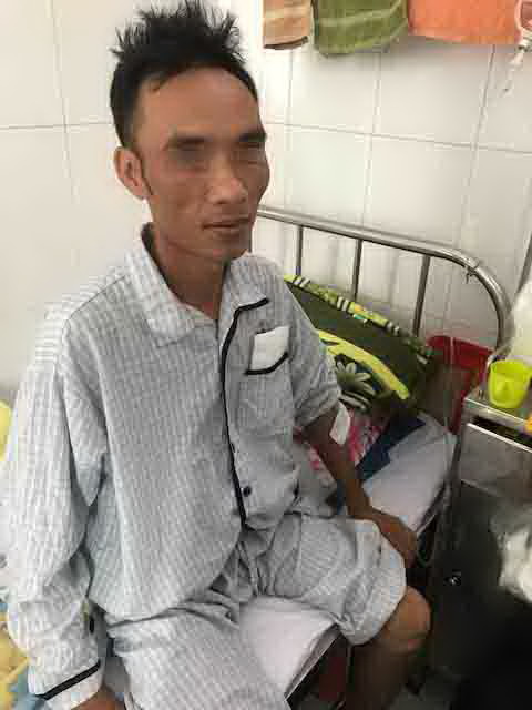 Su&yacute;t chết do bị cọc b&ecirc; t&ocirc;ng th&uacute;c v&agrave;o bụng - Ảnh 1.