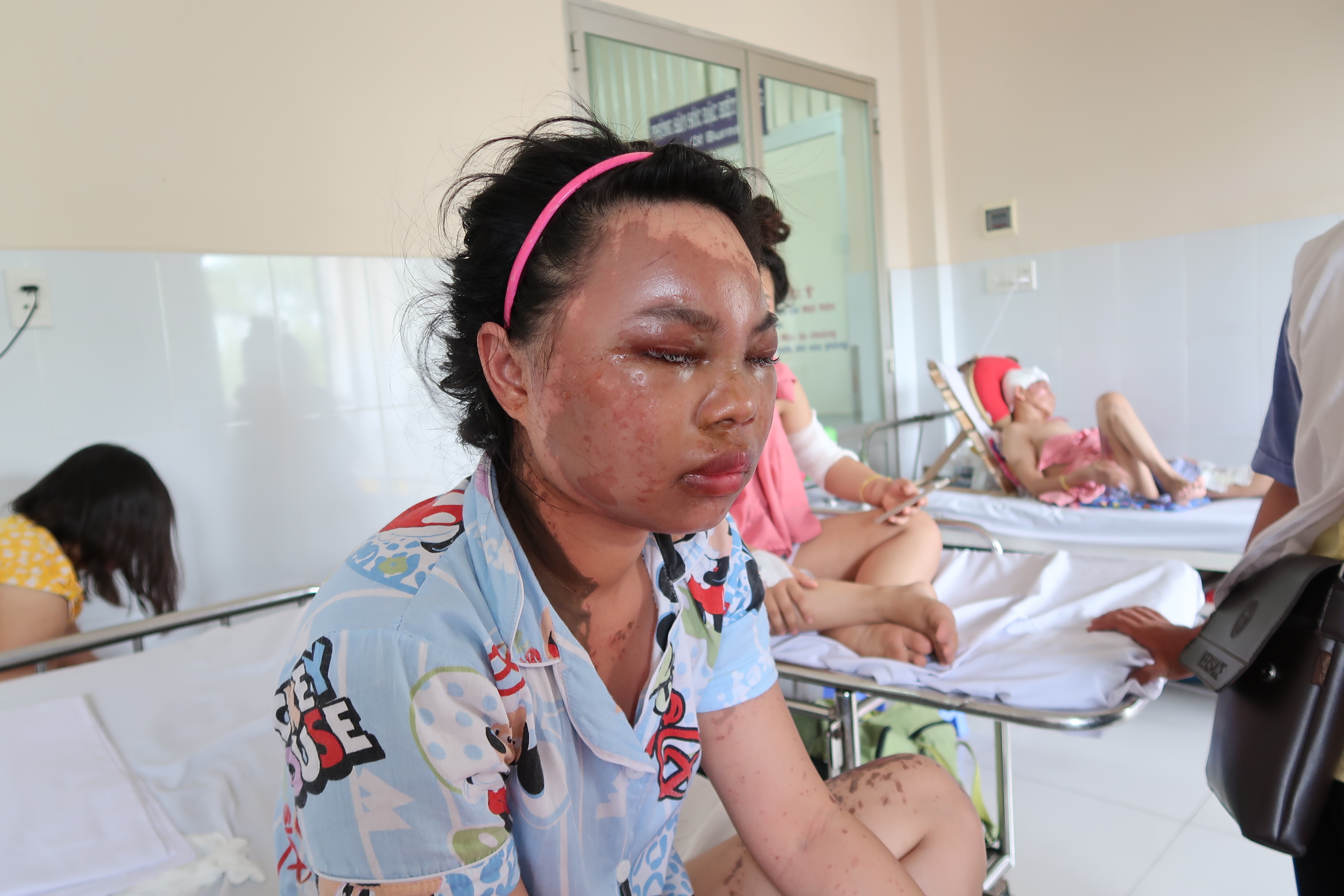 Lời kể kinh hoàng của 4 nạn nhân bị tạt a xít