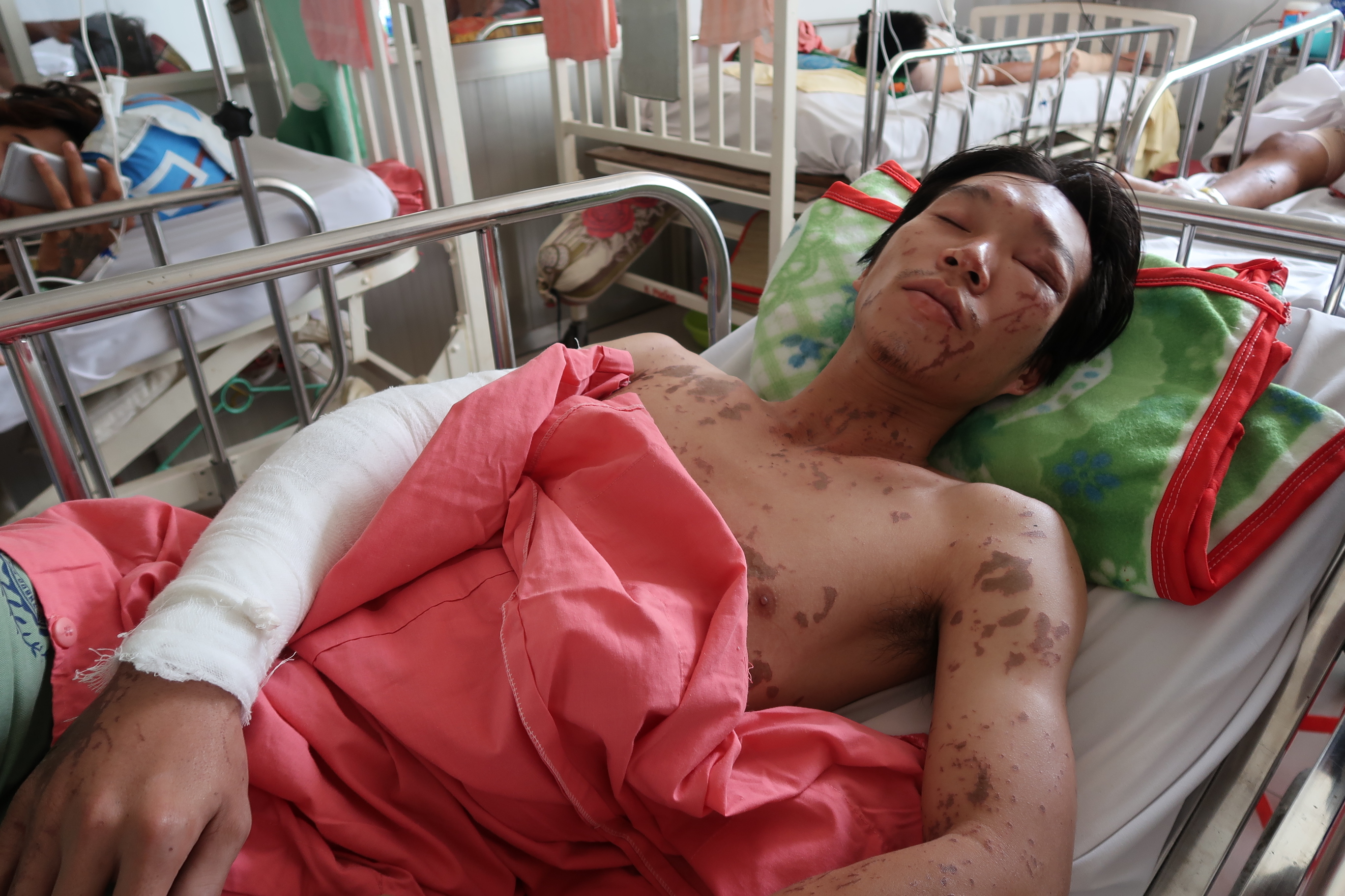 Lời kể kinh ho&agrave;ng của 4 nạn nh&acirc;n bị tạt a x&iacute;t - Ảnh 6.