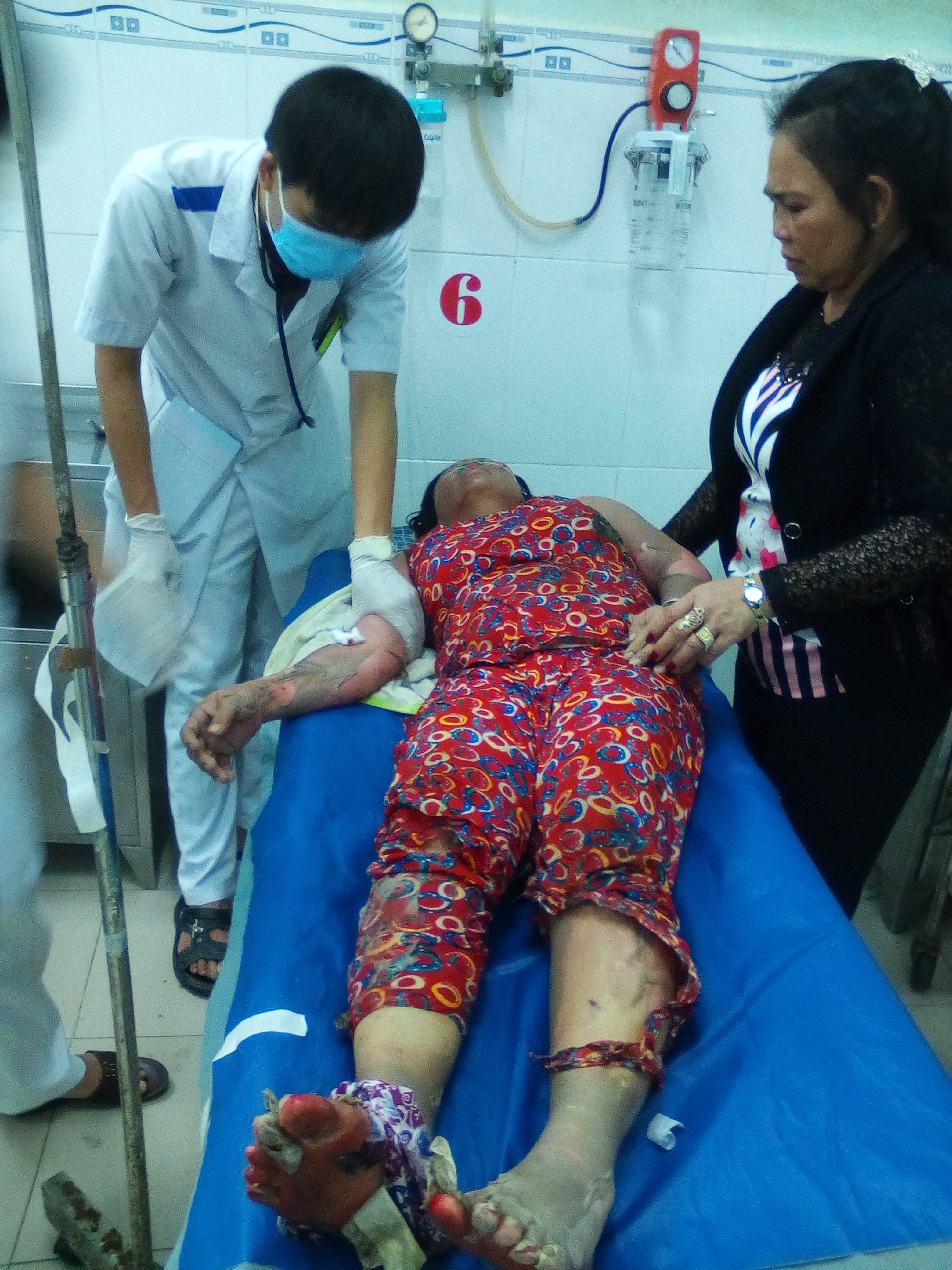 
B&agrave; Trinh l&uacute;c cấp cứu tại Bệnh viện Đa khoa Tr&agrave; Vinh
