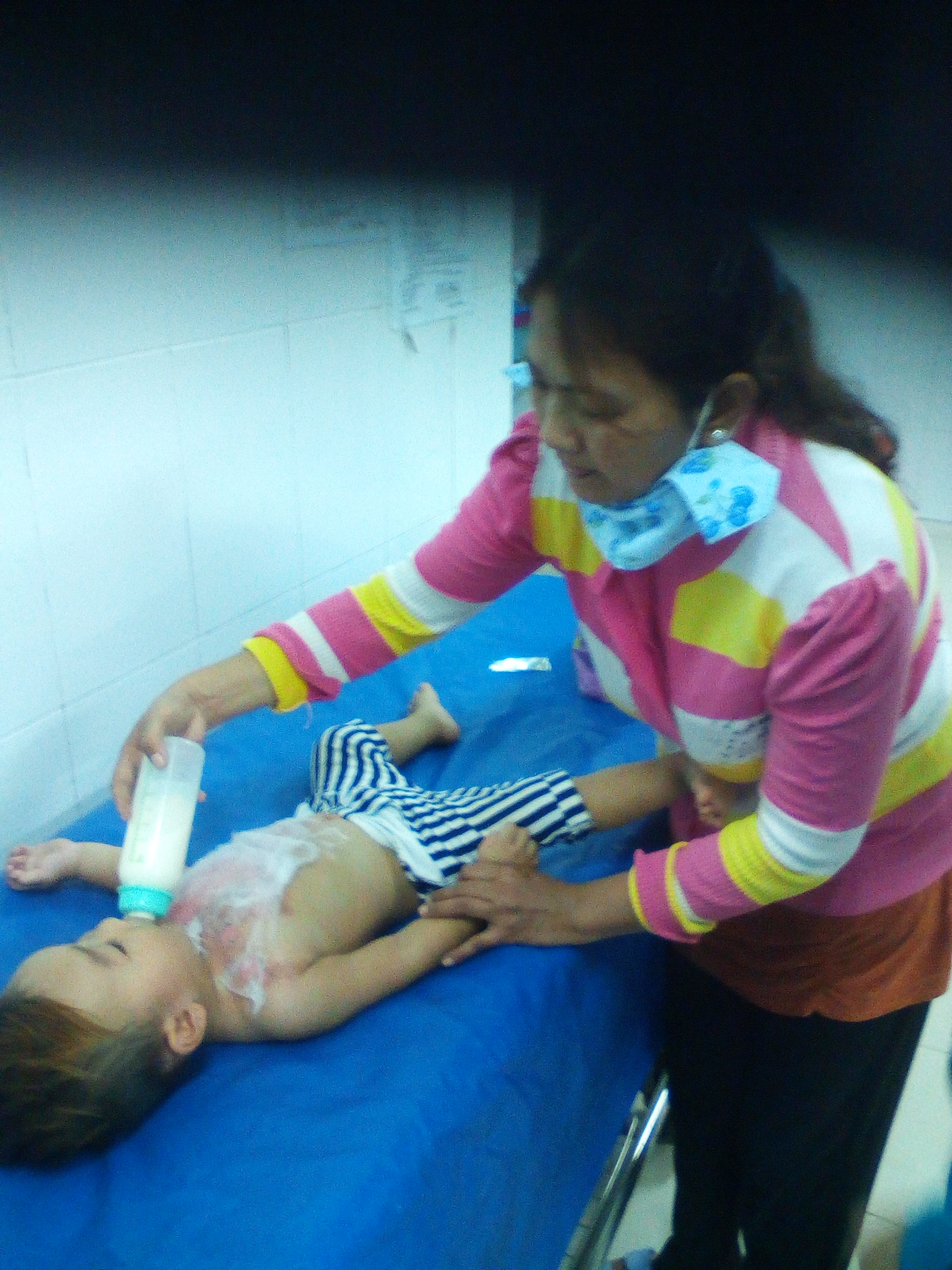 Ông nội uống trà, bé 17 tháng tuổi bị bỏng nặng