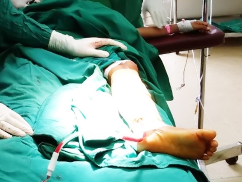 Suýt mất chân do cắt lể dân gian