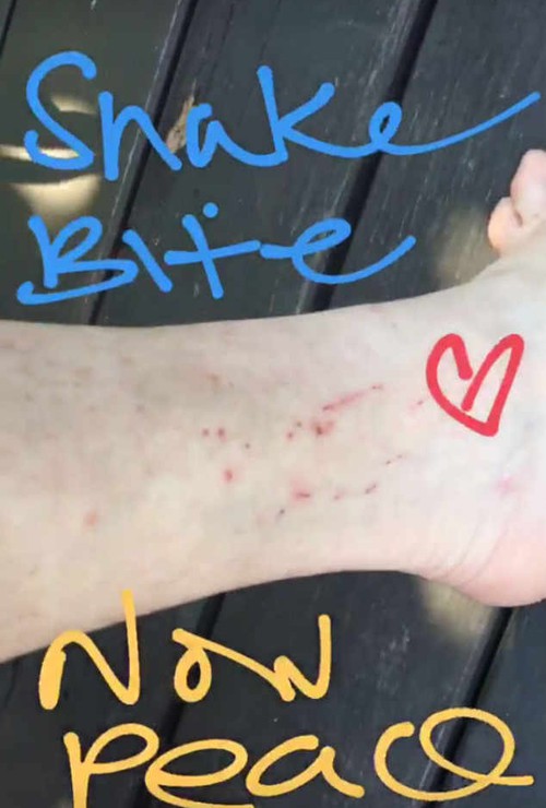 Lindsay Lohan bị rắn cắn ở Thái Lan - Ảnh 2.