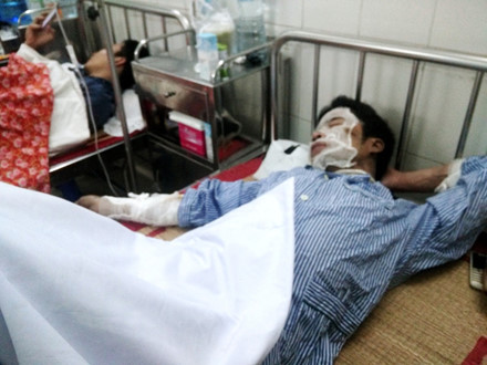Lò nấu phôi thép phát nổ, 4 người bỏng nặng