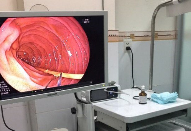 Nhậu thiếu mồi, nuốt luôn 6 cây nhang đang cháy