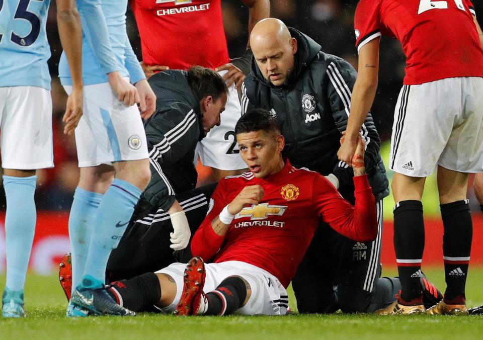 Rojo khoe chấn thương ghê rợn sau trận gặp Man City - Ảnh 3.