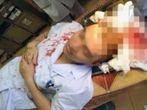 Phó khoa hồi sức cấp cứu bị bố bệnh nhi đánh khâu 7 mũi
