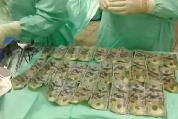 Vợ nuốt 7.000 USD vào bụng để giấu chồng sau khi cãi nhau