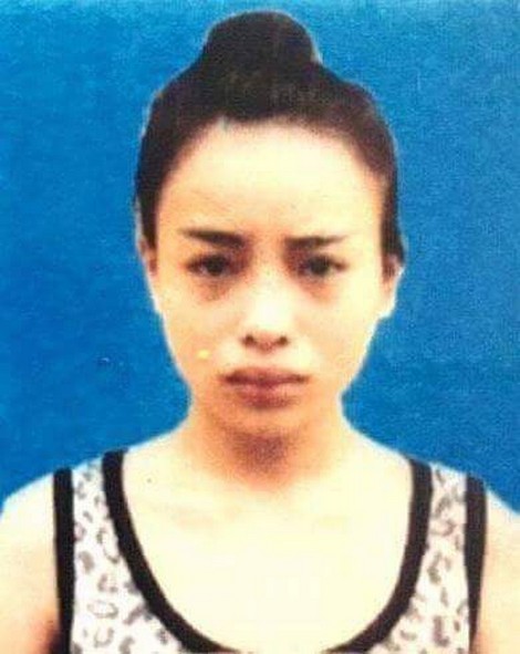 Yến khi chưa phẫu thuật thẩm mĩ.