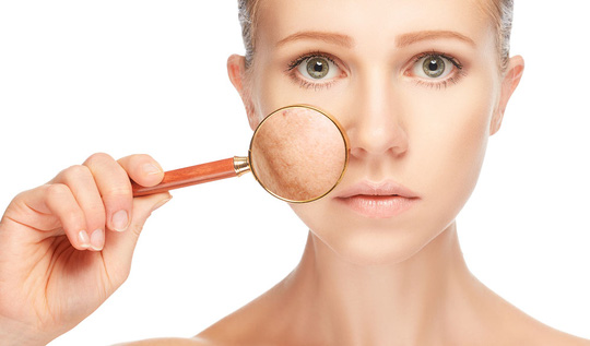 Thuốc tốt nhất trị nám, sạm da là… tránh nắng - Ảnh 1.
