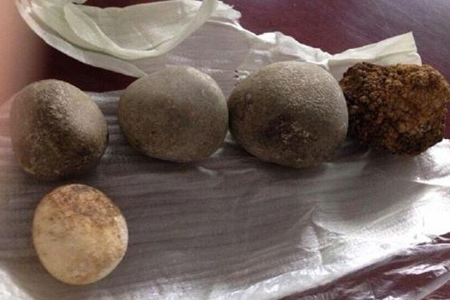 Sỏi mật tr&acirc;u b&ograve; đắt như v&agrave;ng r&ograve;ng: 300 triệu/kg - Ảnh 3.