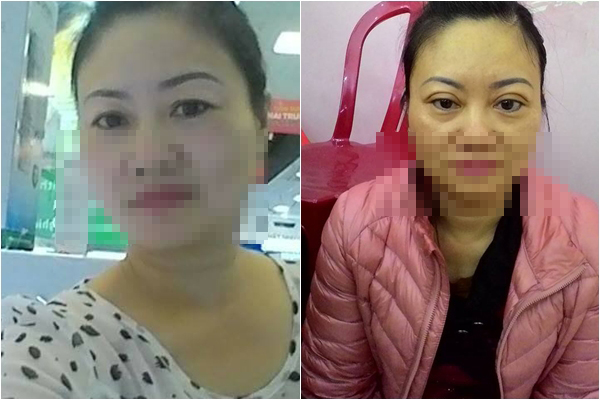 Tai nạn khi làm đẹp đón Tết khiến chị em dở khóc dở cười