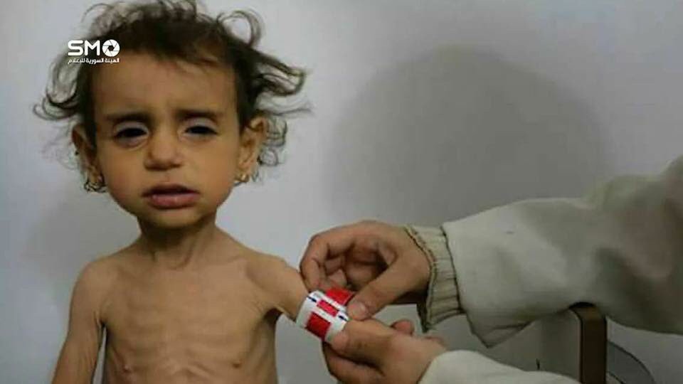 Cạn lương thực, người d&acirc;n Syria phải lục th&ugrave;ng r&aacute;c - Ảnh 4.