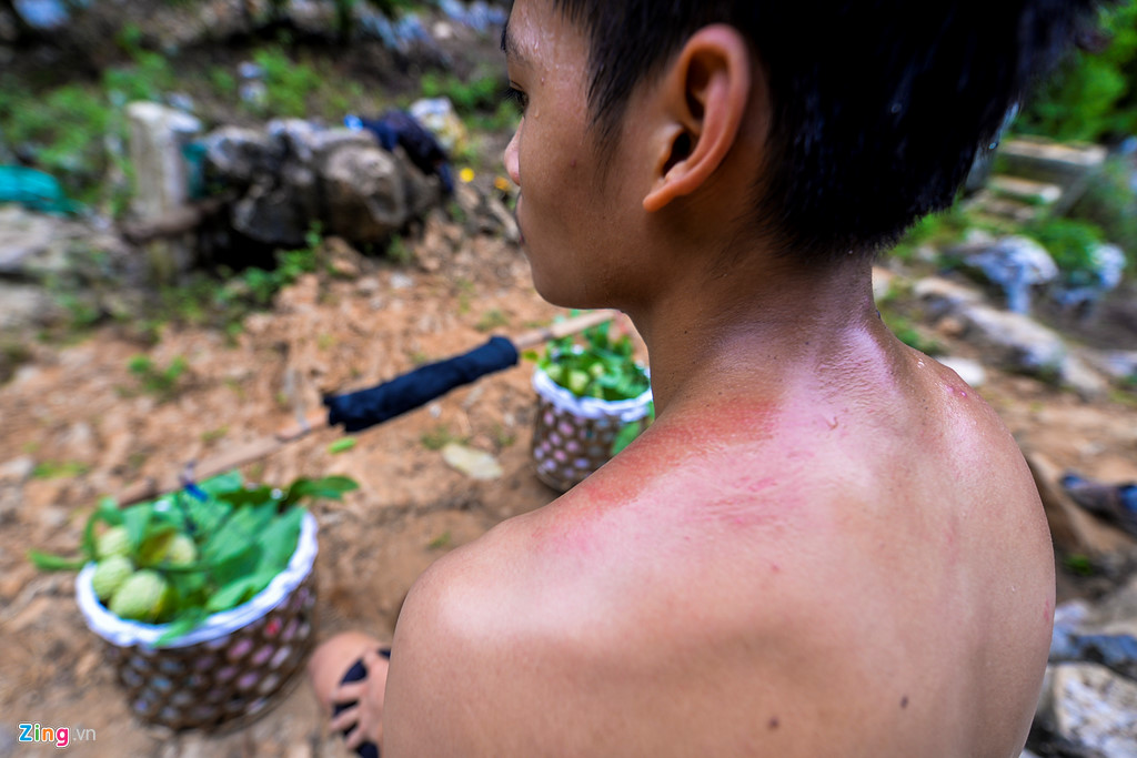 Nhọc nhằn trồng na tr&ecirc;n n&uacute;i đ&aacute; - Ảnh 8.