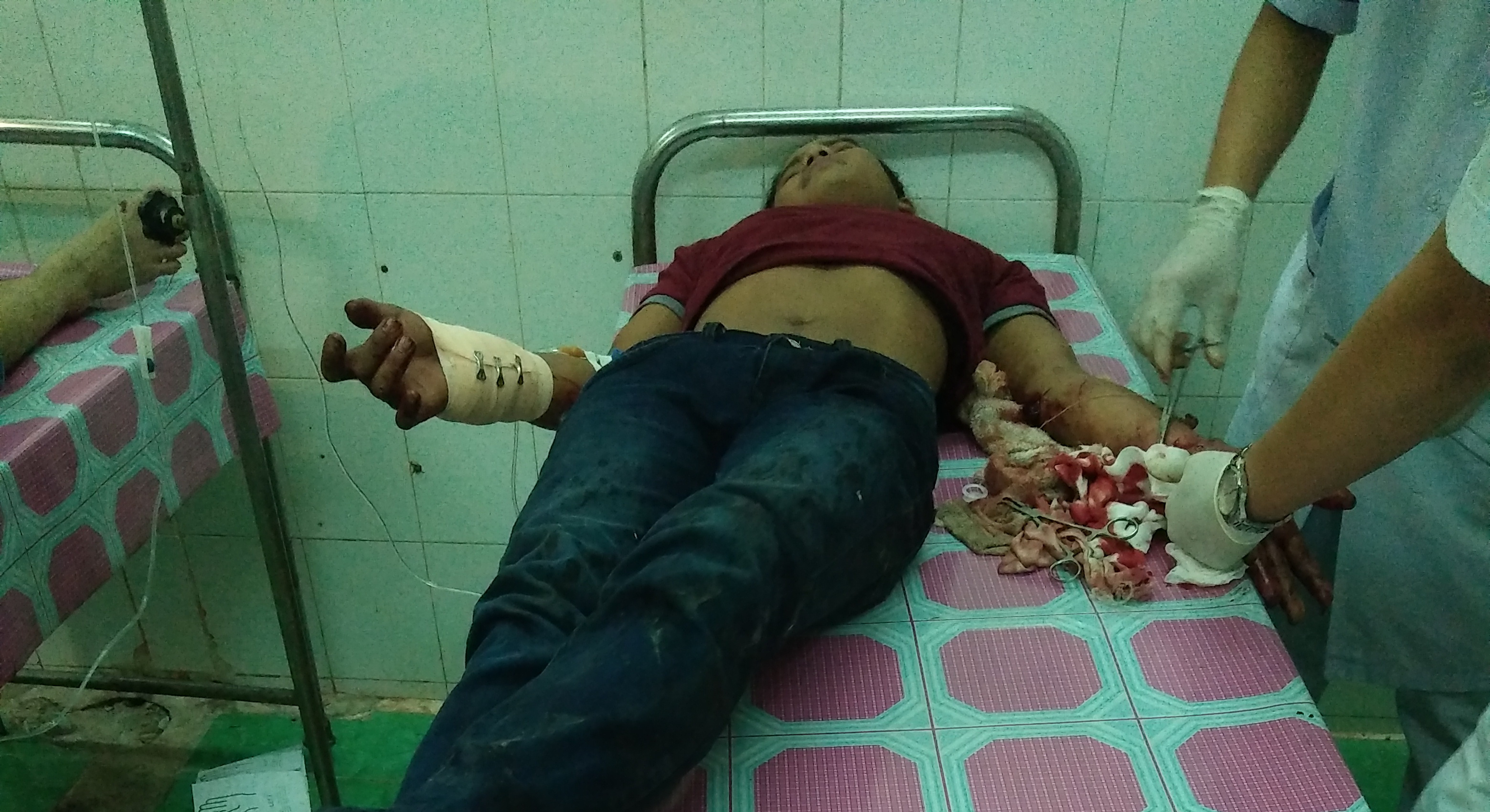 Đi thăm bác ruột, bị chém đứt gân tay trong đêm