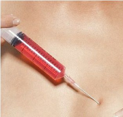 Ngày mai xử vụ thuê người tiêm máu có HIV vào con tình địch