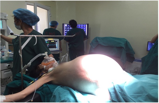 Cô gái 22 tuổi “đeo” khối u buồng trứng 16 kg