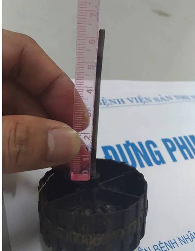 Bé 11 tháng bị trục sắt bánh xe đồ chơi dài 7 cm cắm vào đầu - Ảnh 2.